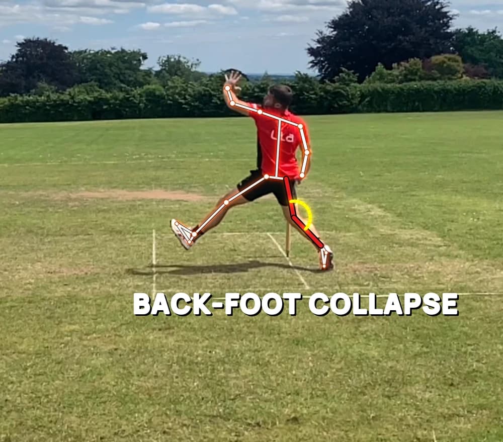Back-leg collapse, marked on a real bowling action