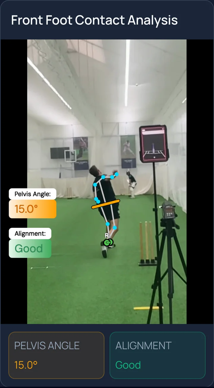 Injury Scan: front-foot landing