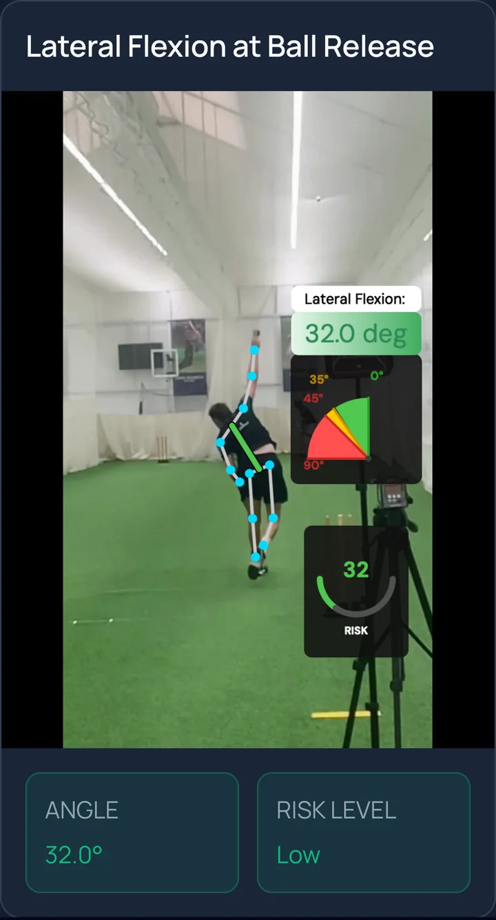 Injury Scan: side bend at release