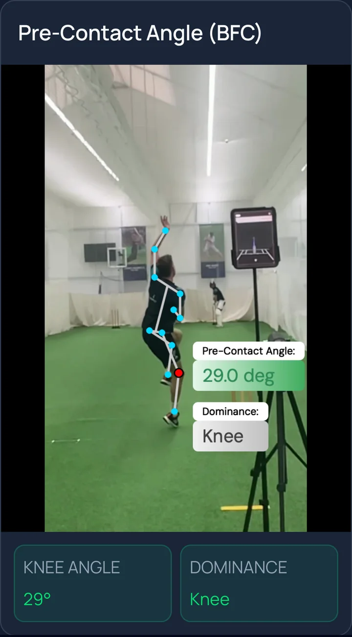 Injury Scan: back-foot landing